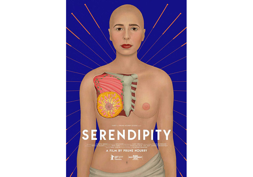 Prune Nourry’nin Göğüs Kanseri Yolculuğu: Serendipity