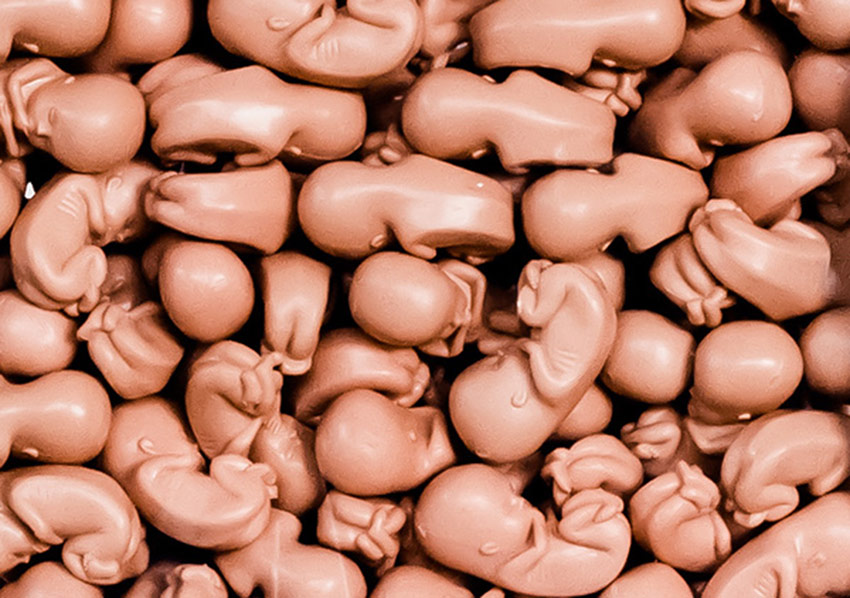 Sürrealizmin Geleneksel Araçlarla Tekrar Yorumu